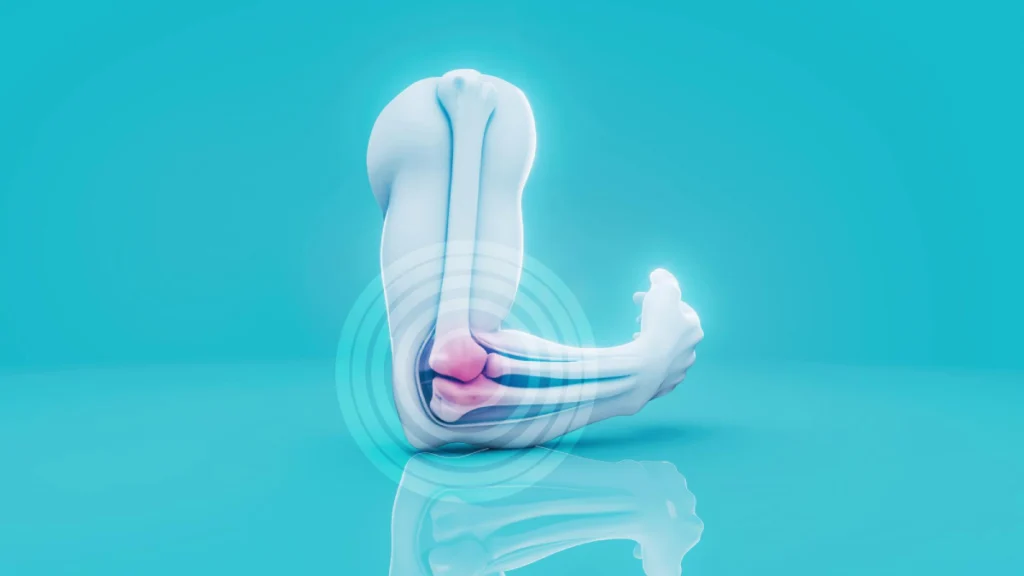 Beyond Calcium: Omega-3 Fatty Acids for Bone Health!